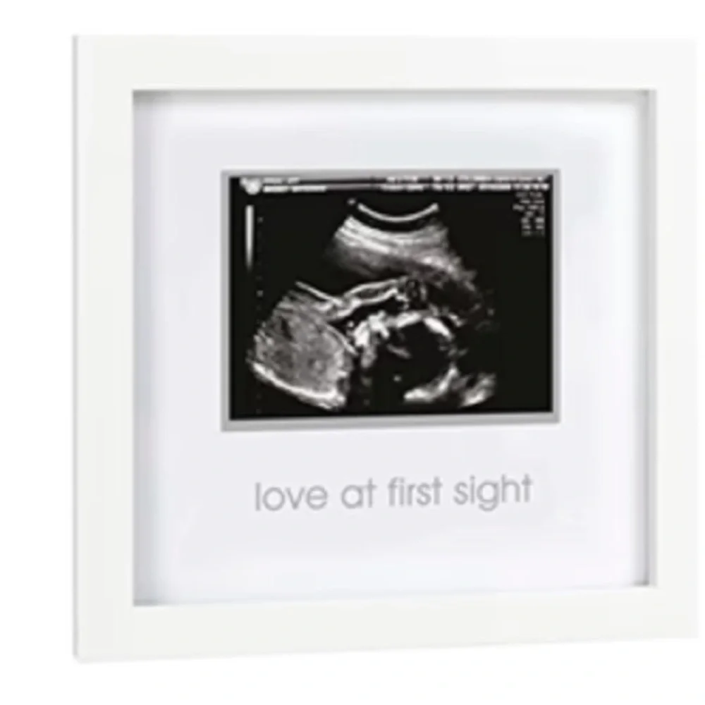NWT Pearhead Ultrasound Picture Sonogram Frame “Love at First Sight”
